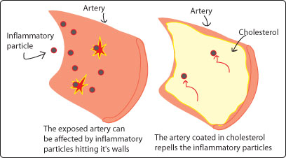 Inflammatory Artery Illustration